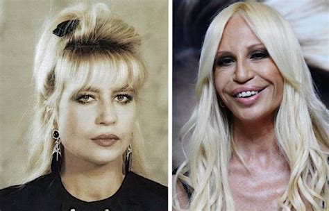 donatella versace prima|donatella versace before and after.